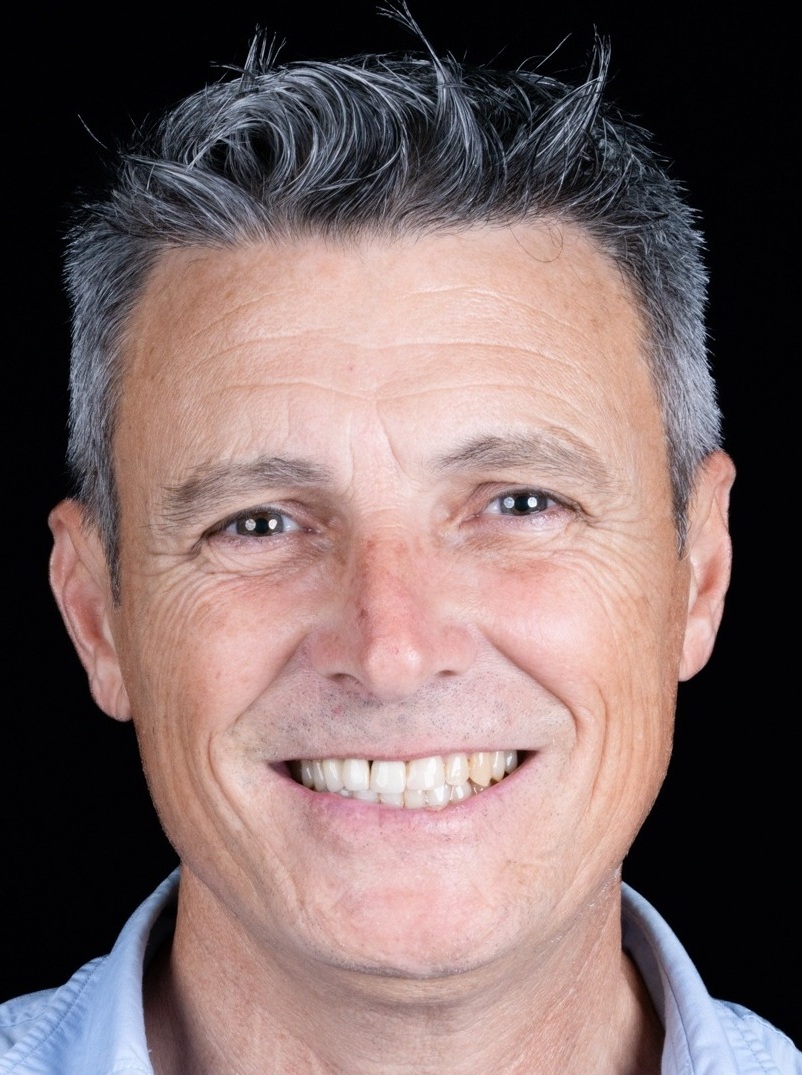 carillas de disilicato de litio antes
