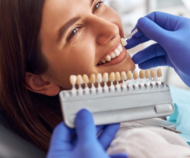 Requisitos para ponerse carillas dentales