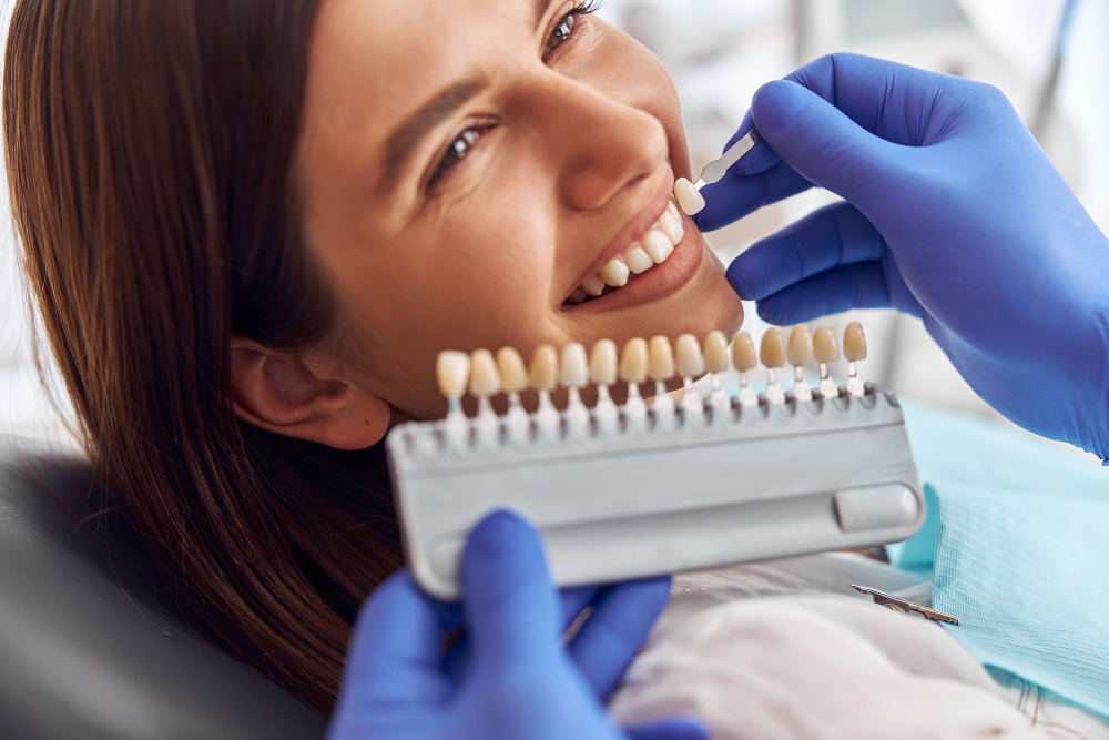 Requisitos para ponerse carillas dentales: ¿cuáles son?